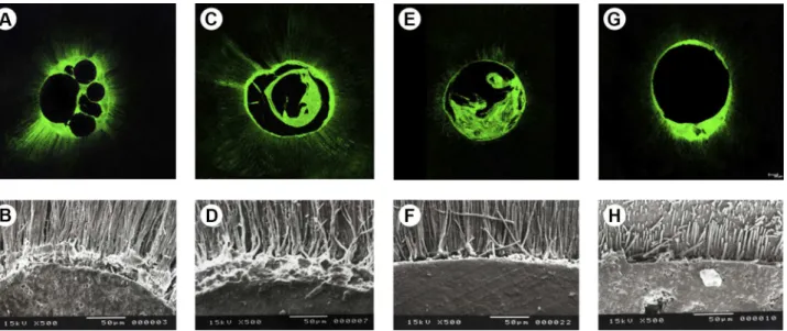 Figure 1. CLSM micrographs and SEM micrographs representing the root canal filling techniques of lateral condensation (A, B), vertical compaction  (C, D), modified Tagger’s hybrid (E, F) and single cone (G, H)