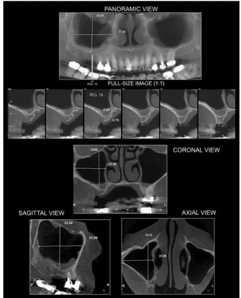 Figure 1. Representative image of templates used in study.