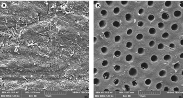 Figure 2. A: Representative micrograph of the dentin surface with the smear layer obliterating dentinal tubules
