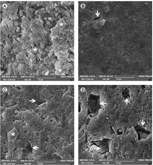 Figure 4. Dentin surface treated with Clinpro XT Varnish. A: Fluoroaluminosilicate glass particles (asterisk) observed after the application of the  varnish