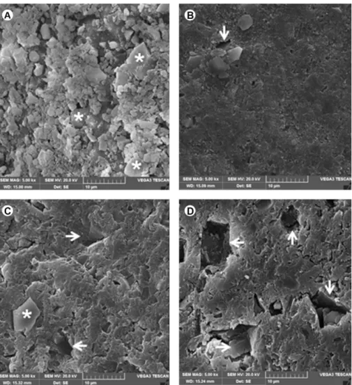 Figure 6. Dentin surface treated with Nano-P. A: Dentinal tubules partially (arrow) and completely (asterisk) occluded probably by calcium  phosphate particles after the application
