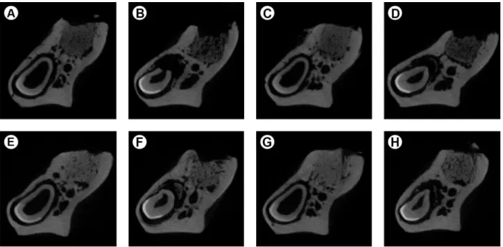 Table 2. Mean and standard deviation of trabecular bone  microarchitecture data regarding trabecular analysis for each group