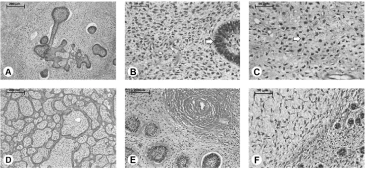 Figure 1: A) Tumor showing an ameloblastic fibroma-like pattern (hematoxylin and eosin staining, (HE), 10×)