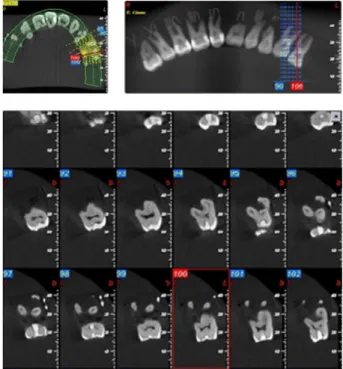 Figure 3. CBCT Newtom3G imaging of specimens. Figure 4. CBCT Cranex 3D imaging of specimens.
