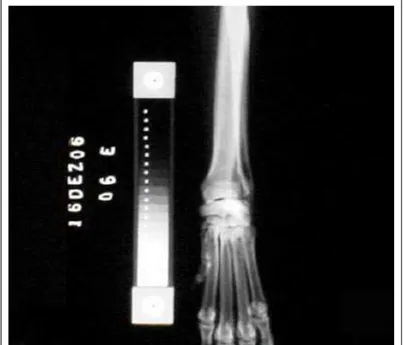 Figura 1 - Imagem radiográfica da extremidade distal do membro torácico esquerdo de um cão