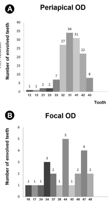 Figure 3. Quantity and distribution of the teeth involved in cases of  (A) periapical COD and (B) focal COD.