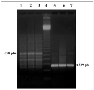Figura 1 - Visualização de material genético amplificado, específico de VIF, da reação de PCR e PCR-Nested