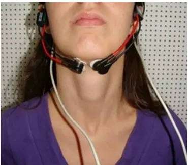 Figure 1. Placement of the recording electrodes