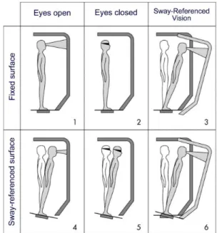Figure 1. Computerized dynamic posturography 