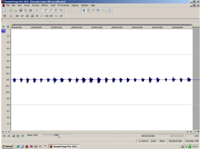 Figure 3. Analysis of speech samples by the Kay-Pentax TM  Motor Speech Profile Advanced softwareFigure 2