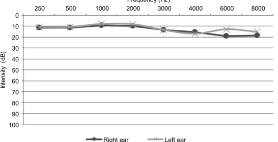 Figure 1. Mean of hearing thresholds of both ears, of the subjects of the control group
