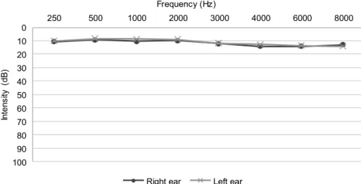 Figure 2. Mean of hearing thresholds of both ears, of the subjects of the experimental group