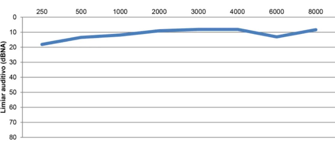 Figura 2. Distribuição dos limiares auditivos médios dos dois grupos estudados