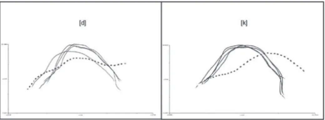 Figure 4. Tongue splines referring to the stop production [d] and [k] of an individual with phonological disorders and the use of the alveolar pos- pos-teriorization strategy in his speech