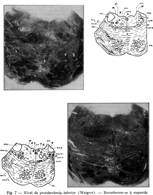 Fig. 8 — Nivel da protuberância superior (Weigert). — Reconhecem-se as fibras  de emergência do V nervo à esquerda e do  V I I nervo à direita (há ligeira  assi-metria do corte)