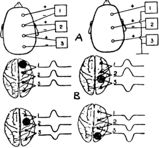 FIG. 1 —  E m  A , modo de ligação dos eletrodos no  método bipolar mostrando que cada área examinada  está simultaneamente ligada a dois inscritores vizinhos,  funcionando como polo positivo em um e negativo em  outro