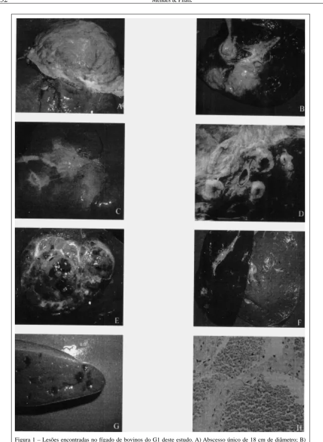 Figura 1 – Lesões encontradas no fígado de bovinos do G1 deste estudo. A) Abscesso único de 18 cm de diâmetro; B) Abscessos múltiplos de 5 a 8 centímetros de diâmetro; C) Fibrose acentuada focalmente extensa com colapso do parênquima e espessamento de duct