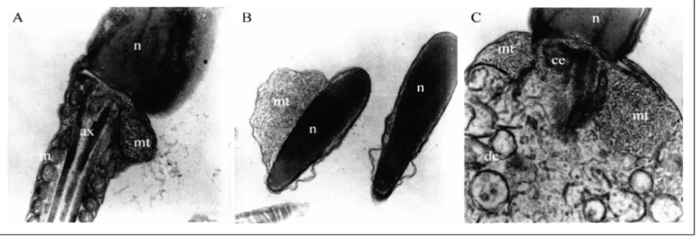 Figura 1 - Micrografias de espermatozóides de jumento obtidas por microscopia eletrônica de transmissão (MET)
