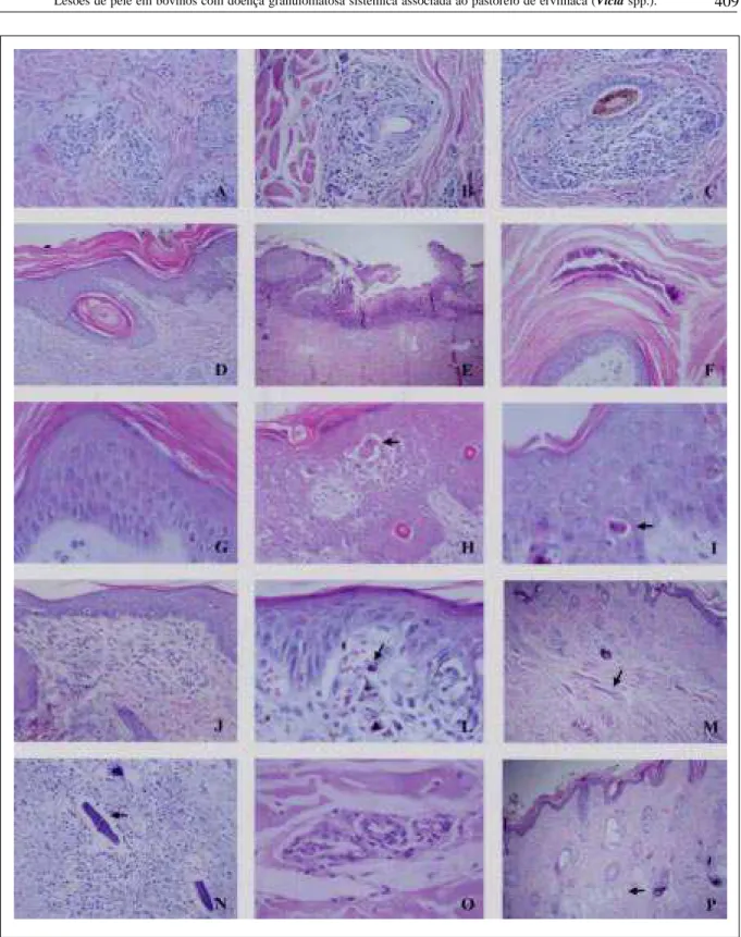 Figura 1 - Prancha com as principais lesões histológicas encontradas na pele dos bovinos com doença granulomatosa sistêmica associada ao pastoreio de ervilhaca (Vicia  spp.)