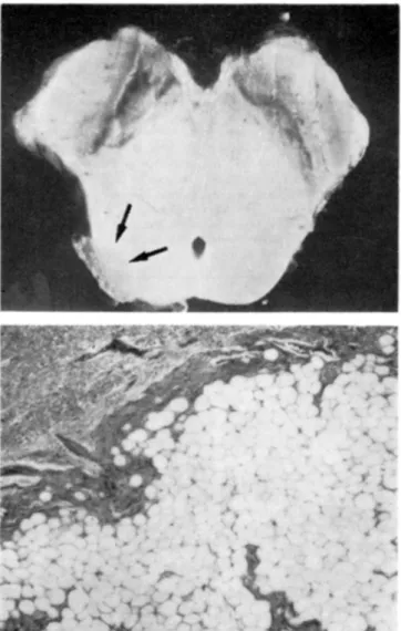 Fig. 1 — Case HFS. Above: 