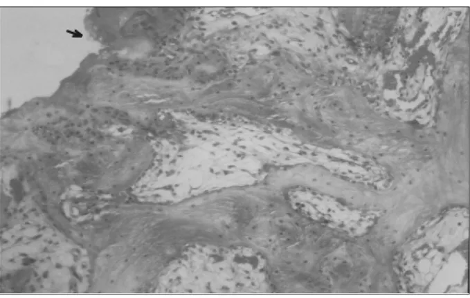 Figura 2 – Aspecto microscópico da superfície articular da tróclea esquerda (controle) aos 30 dias de pós-operatório
