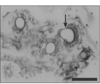 Figura 4 - Avestruz. Saco aéreo; superfície interna contendo vários micélios com conidióforos (seta grande) e esporos (seta pequena) de Aspergillus sp