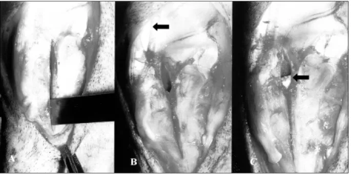 Figura 1 - Imagem fotográfica demonstrando a técnica cirúrgica: A) osteotomia longitudinal na porção central da face medial proximal da tíbia (seta: crista tibial)