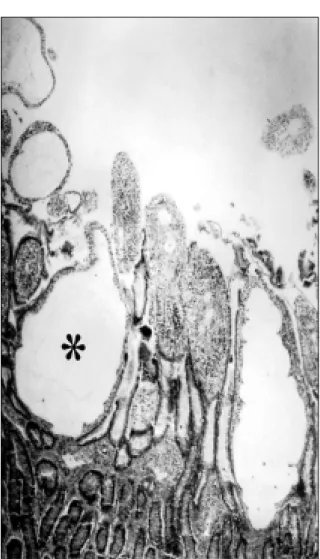 Figura 3 - Linfangiectasia intestinal/linfangite lipogranulomatosa. Canino 1. Acentuada ectasia dos vasos lactíferos das vilosidades intestinais (asterisco)