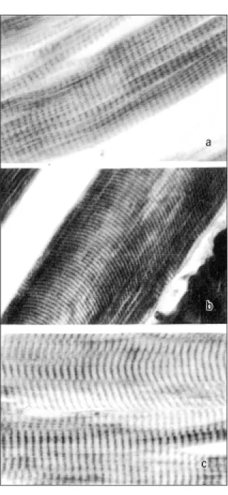 Figura 1 -  Fotomicrografias do músculo Longissimus dorsi: durante o resfriamento industrial, mostrando as bandas A e I (aumento de 1000 vezes), fixado com formalina tamponada neutra e corado com Hematoxilina Fosfotúngstica de Mallory:  a)  na 1 a