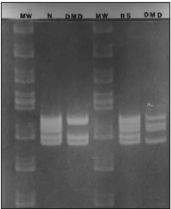 Fig 3. PCR analysis of the dystrophin gene: comparison with Duchenne muscular dystrophy (MW, molecular weight; N, normal; DMD,  Du-chenne muscular distrophy; RS, rigid spine).