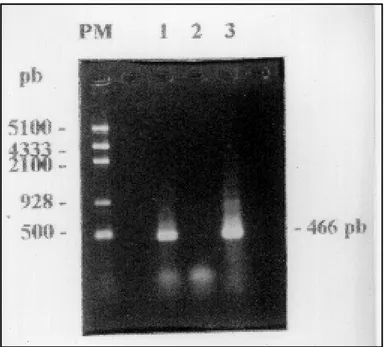 Fig 1. HTLV-I proviral amplification in peripheral blood mononuclear cells (PBMCs) of patient RPR, using nested PCR product with primers SK 110 (pol) / SK 44 (tax) in the external reaction and 248/249 (env region) in the internal.