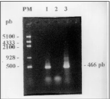 Fig 1. HTLV-I proviral amplification in peripheral blood mononuclear cells (PBMCs) of patient RPR, using nested PCR product with primers SK 110 (pol) / SK 44 (tax) in the external reaction and 248/249 (env region) in the internal.