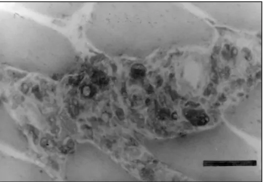 Fig 3. Inflammatory cells (macrophages) in the interstitial, spreading into the endomysium through the vasculo- vasculo-nervous space