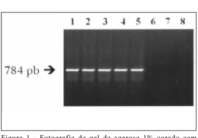 Figura 1 - Fotografia de gel de agarose 1% corado com brometo de etídio da eletroforese dos produtos de amplificação com 784pb de Ornithobacterium rhinotracheale