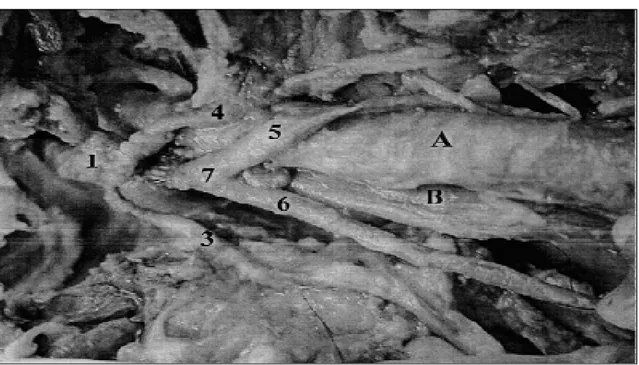 Figura 2  Arco aórtico do gambá (Didelphis albiventris) e seus colaterais, mostrando a formação do tronco braquiocefálico: 1