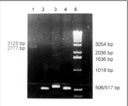 Fig 1. PCR analysis of intron 1 of the X25 gene of Case 4 and three normal controls. The PCR products were electrophoresed on a 1% agarose gel stained with ethidium bromide.