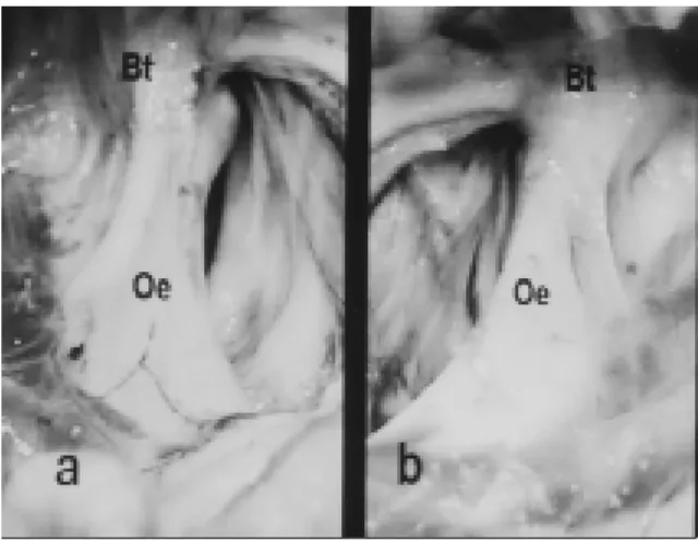 Figura 1  Osteoartropatia da articulação temporoioídea do lado esquerdo (B) em um equino comparado com o lado normal (A) ao exame de necrópsia; mostrando alteração de contorno de bula timpânica (Bt) esquerda e aumento de volume de extremidade proximal do 