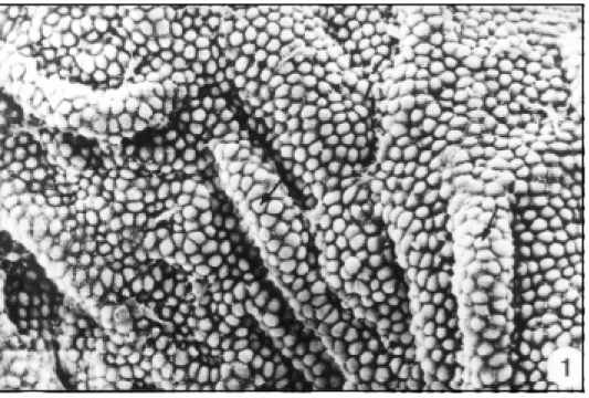 Figs 1 and 2. Choroid plexus of the lateral ventricles showing a series of longitudinal folds with variable extensions.
