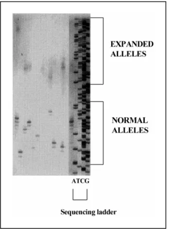 Fig 1. Analysis of PCR products containing the expanded CAG repeat at the HD locus. Genomic DNA was amplified using primers HD1 e HD3 (ref.20)