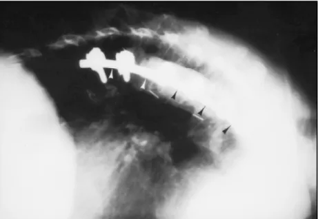Fig 7. Postoperative X-ray of a patient.