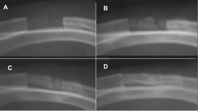 Figura 1 - Radiografia da região operada de um coelho do grupo M. Radiopacidade na região do polímero (A, 7 dias), que se tornou mais intensa em radiografias seriadas (B, C e D, 21, 42 e 63 dias, respectivamente).