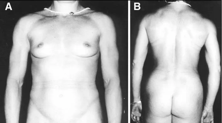 Fig 1. Photograph of the case. A. Anterior view. B. Posterior view.