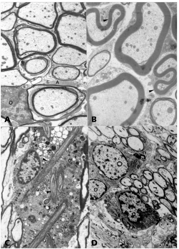 Fig 1. Ethidium bromide (EB) model of demyelination.  (A)  Oligodendrocytes (O) remyelinate axons in an area where many astrocytic (A) processes are detected