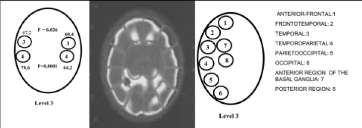 Fig 3. Out line demonst rat ing t he comparison among t he sides right  and lef t  f or t he cont rol group.