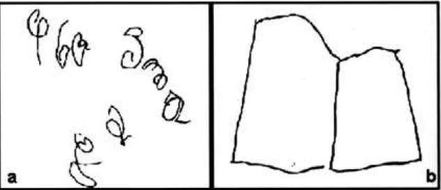 Fig 3.  A macroscopical overview of the brain with frontoparietal cortical atrophy.