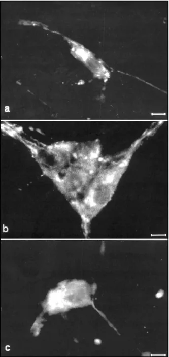 Fig 1. Immunofluorescence micrographs showing VIP immu- immu-noreactivity in the submucous plexus of ileum from untreated controls (a), untreated diabetes (b) and ascorbic acid-treated diabetes (c) groups