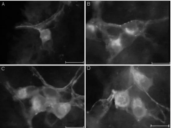 Fig 1. Immunofluorescence micrographs showing imunoreactive VIP-ergic neurons of the jejunum submucous plexus of animals from:  A) non-diabetic group, B) non-diabetic group supplemented with acetyl-L-carnitine, C) diabetic group, D) diabetic group treated 