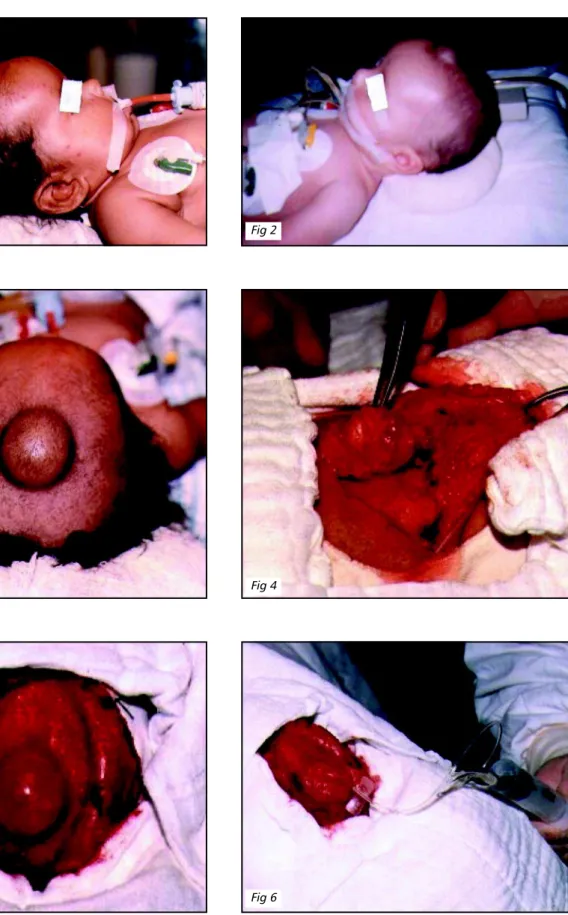 Fig 5 Fig 6Fig 4Fig 2Fig 1