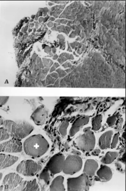 Fig  6. Gastrocnemius muscle from A0 group (A and B) (transverse and oblique sections, H&amp;E, x100 and x400, respectively)