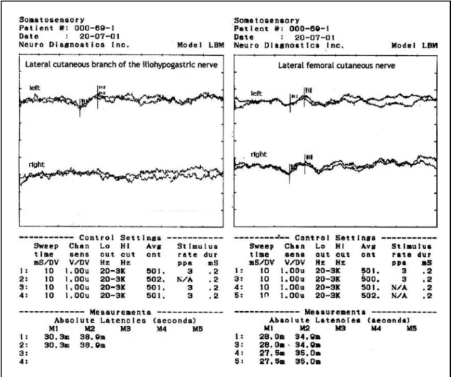 Fig 1. SEP waveforms and instrument parameters.